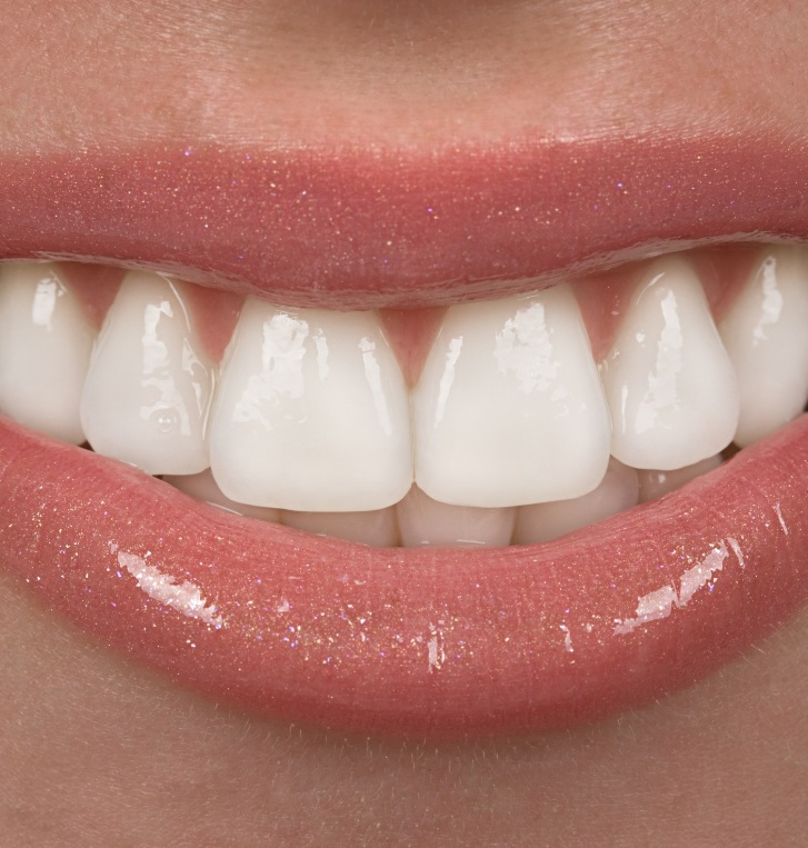 Close up of flawless teeth after a smile makeover in Hillsboro
