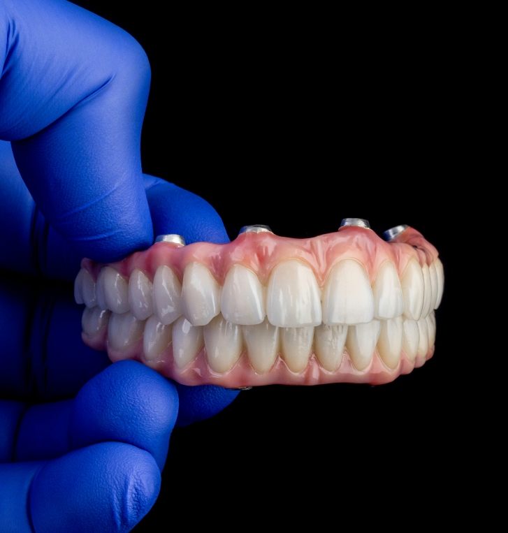 Gloved hand holding a full implant denture