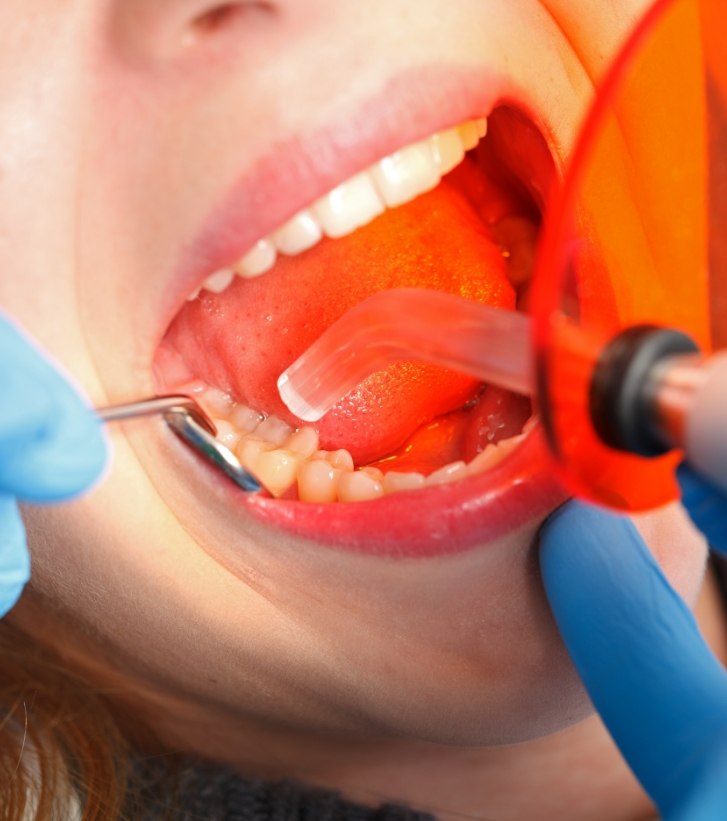 woman having cosmetic dental bonding done on a lower tooth