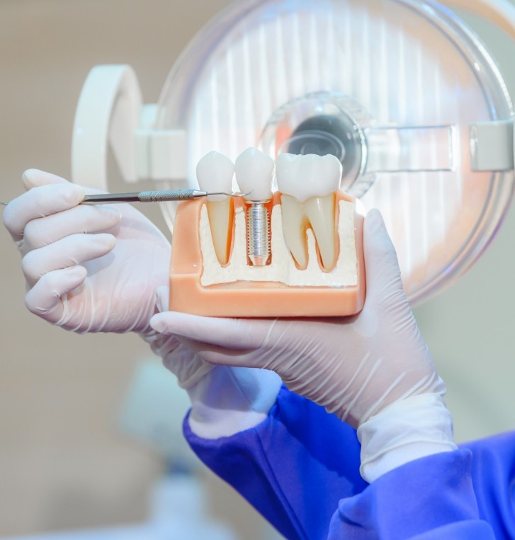 Dentist holding a model of a dental implant in Hillsboro