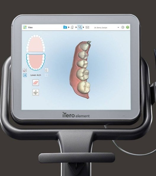 Computer monitor showing digital models of teeth
