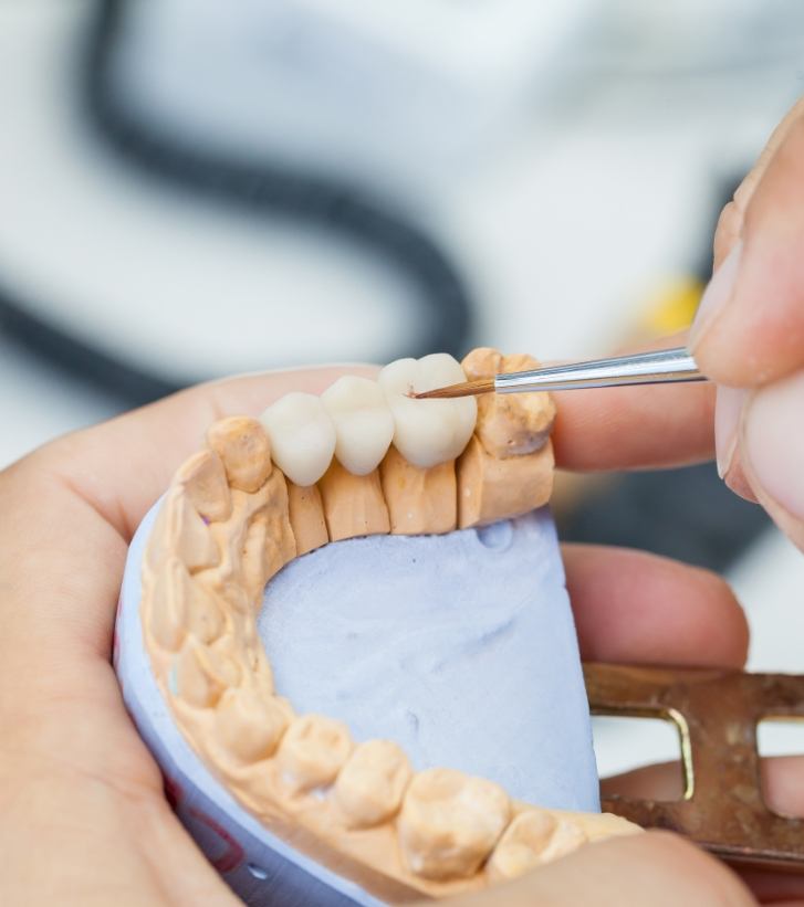 Dental ceramist crafting a dental bridge