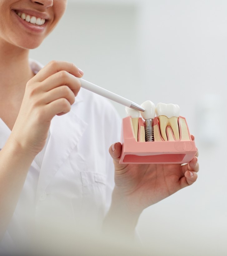 Dentist pointing to a model of dental implants