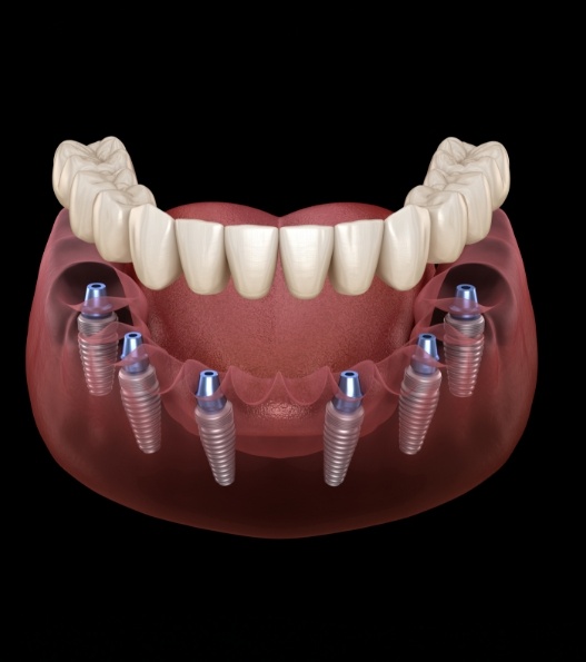 two people sitting at a table with dental X-rays