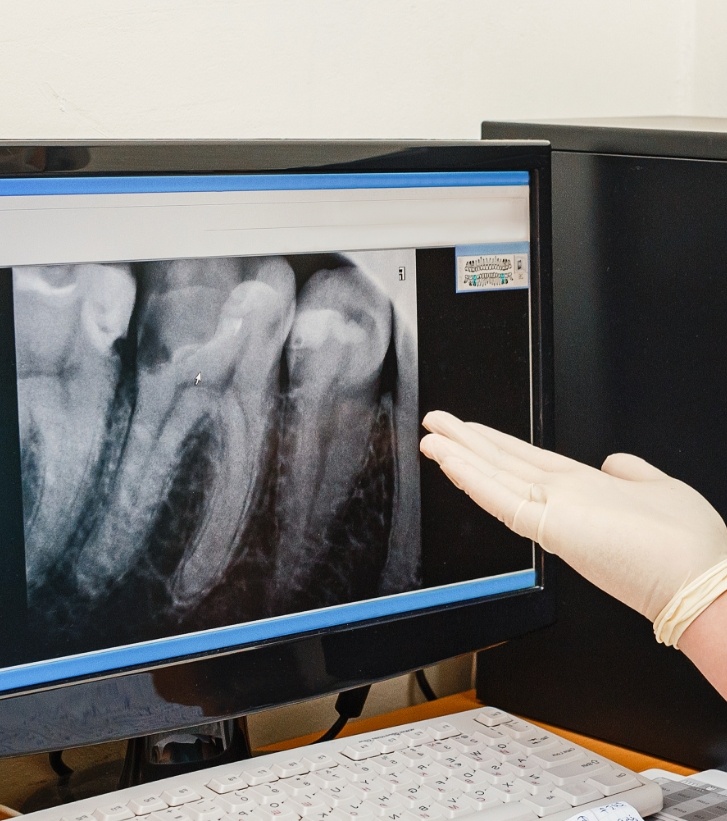 Dentist pointing to computer monitor showing x rays of teeth