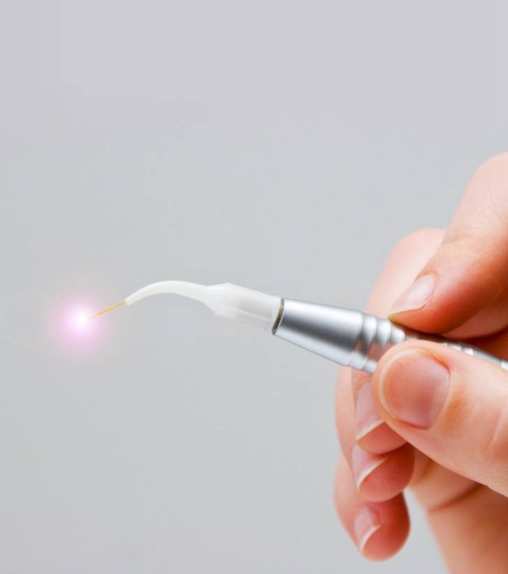 Hand holding a dental laser device