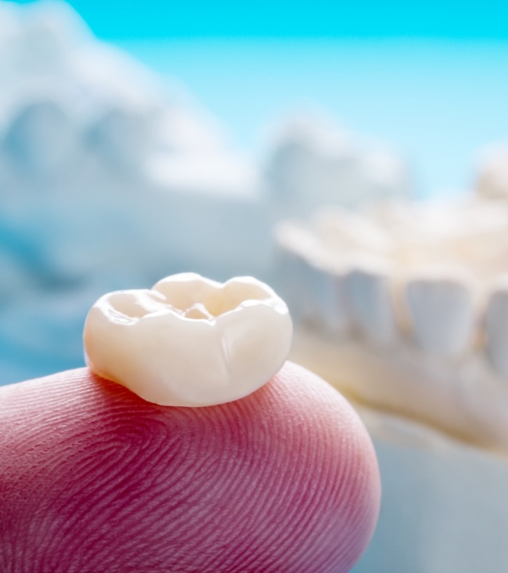 Dental crown resting on a finger