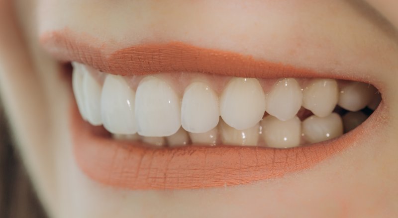 Woman smiling with veneers in Hillsboro